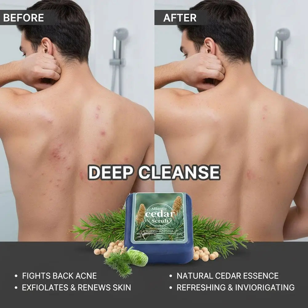 Atlantic Cedar Men's Soap 70g Natural Essential Oil Scrub Bar Deep Cleansing Wood Fragrance Handmade Bath Body Wash